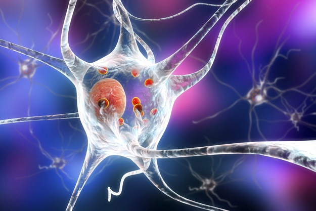 What Causes Parkinson’s Disease? | Parkinson's Disease Treatment Using Reprogrammed Stem Cells
