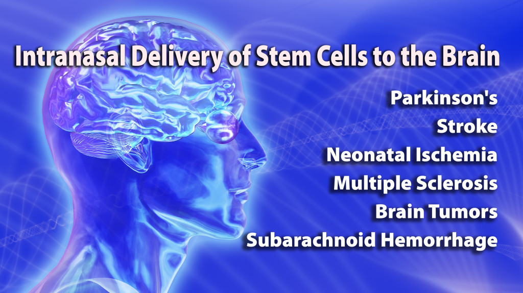 Intranasal Delivery of Stem Cells to the Brain