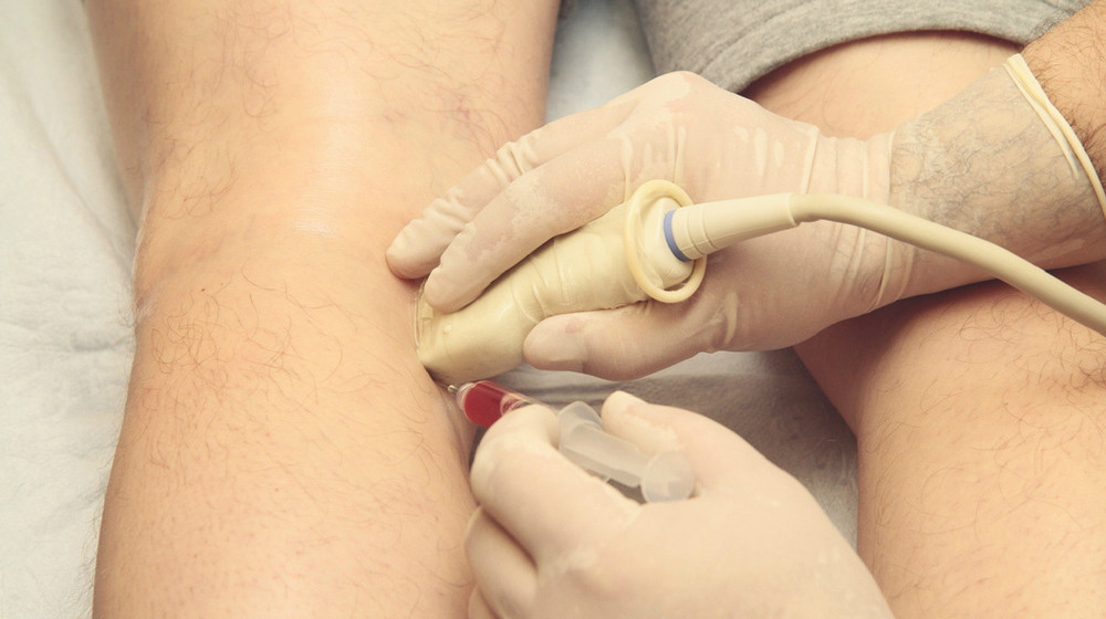 Feature | Stem Cell Injection For Knee Pain, Arthritis, Tendonitis, And More