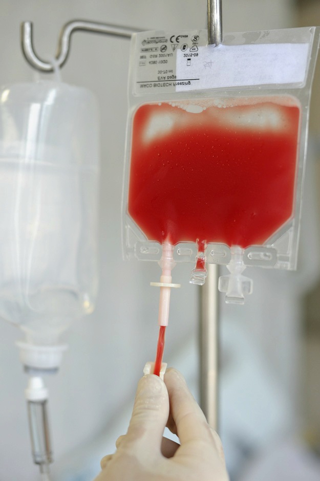 The Day of the Infusion | Stem Cell Infusion: What to Expect