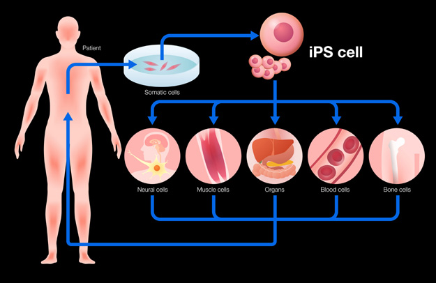 How Are IPS Stem Cells Produced?