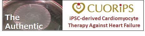 iPSC-derived cardiomyocte therapy