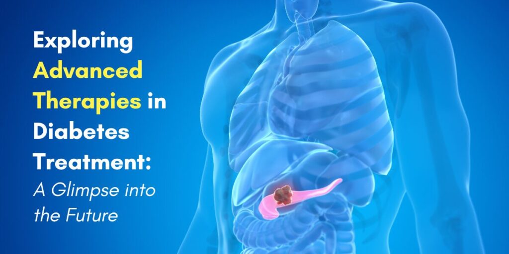 Advanced Therapies for Diabetes