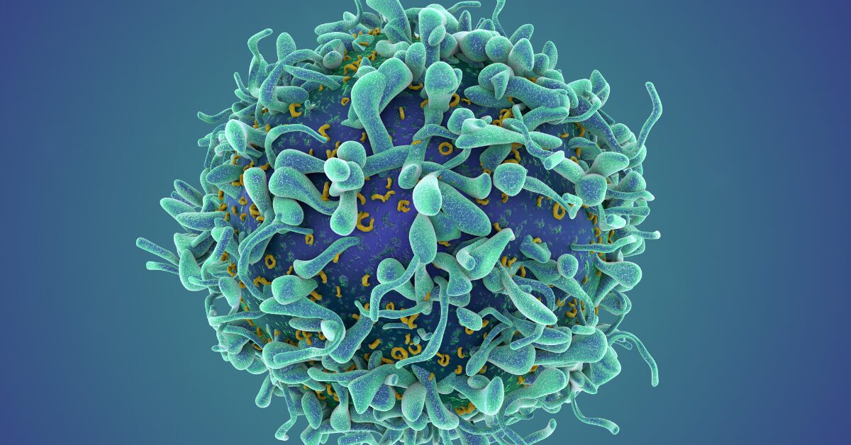 Ways to reduce the cost of CAR-T cell therapy