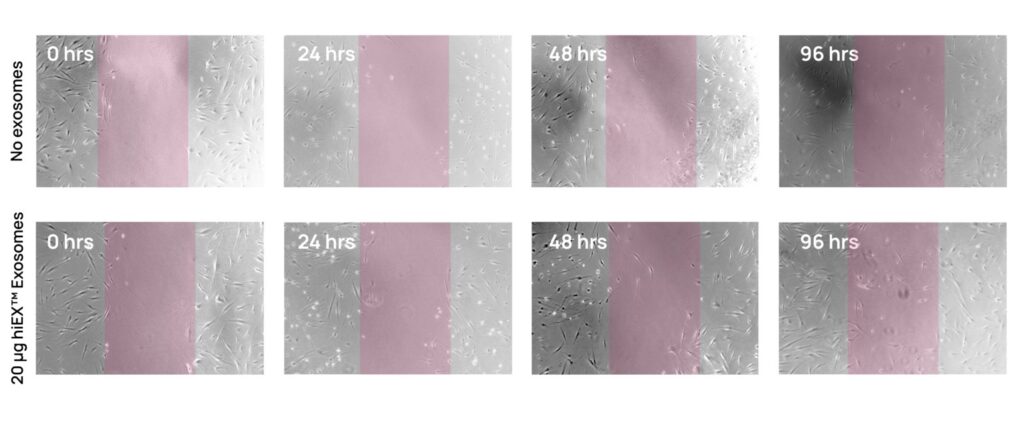 hiEX™ Research iPSC Exosomes