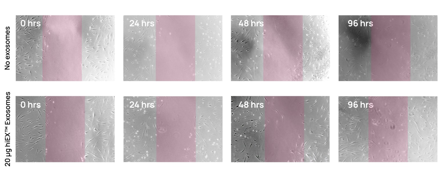 hiEX™ Research iPSC Exosomes