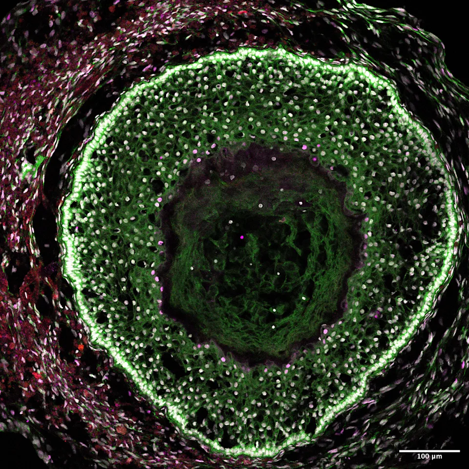 Ovarian Organoid